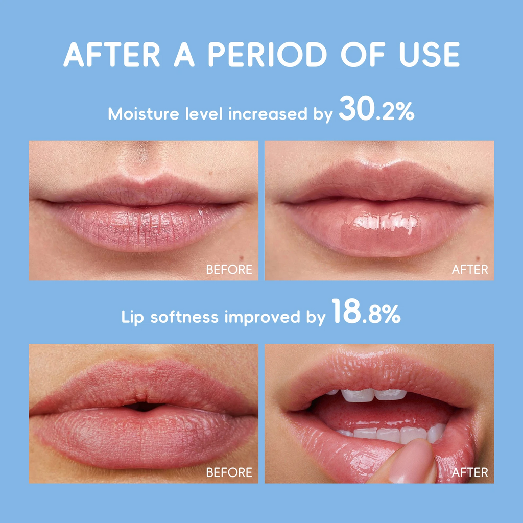 Milk Nourishing Lip Balm 3.5g — Deep Moisturizing, Anti-Dryness & Lip Line Smoothing Stick with Shea Butter, Hyaluronic Acid, Vitamin E & C for Silky Soft Kissable Lips
