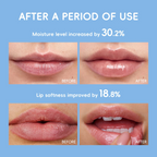 Milk Nourishing Lip Balm 3.5g — Deep Moisturizing, Anti-Dryness & Lip Line Smoothing Stick with Shea Butter, Hyaluronic Acid, Vitamin E & C for Silky Soft Kissable Lips