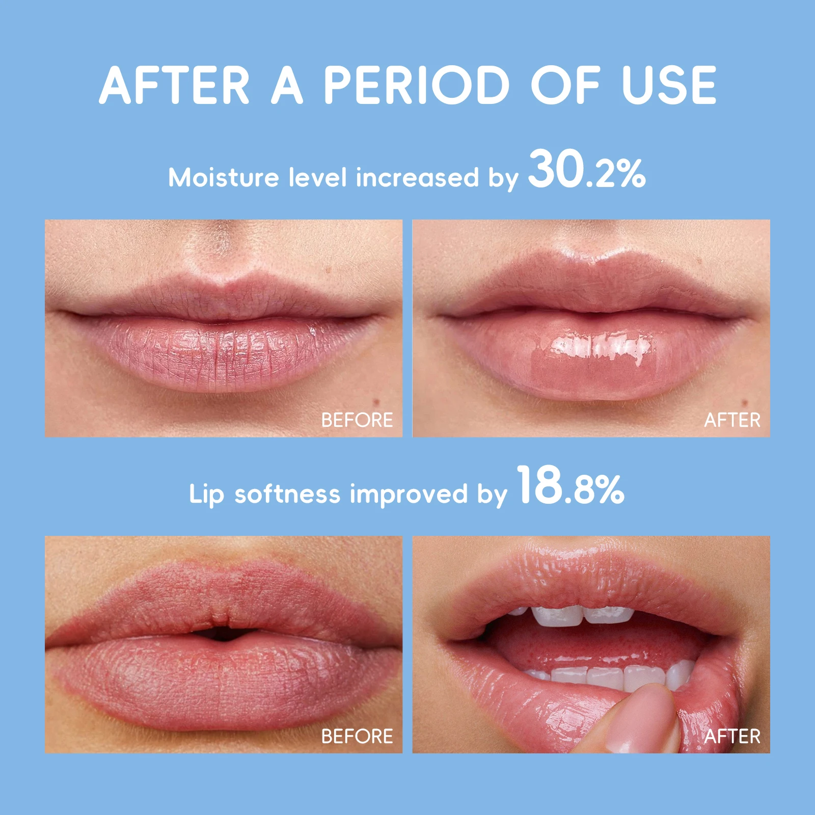 Milk Nourishing Lip Balm 3.5g — Deep Moisturizing, Anti-Dryness & Lip Line Smoothing Stick with Shea Butter, Hyaluronic Acid, Vitamin E & C for Silky Soft Kissable Lips