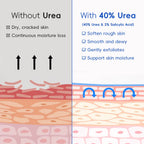 40% Urea & 2% Salicylic Acid Foot Cream – Deep Exfoliating Moisturizing Repair Cream for Cracked Heels, Dry Hands, Rough Elbows & Knees