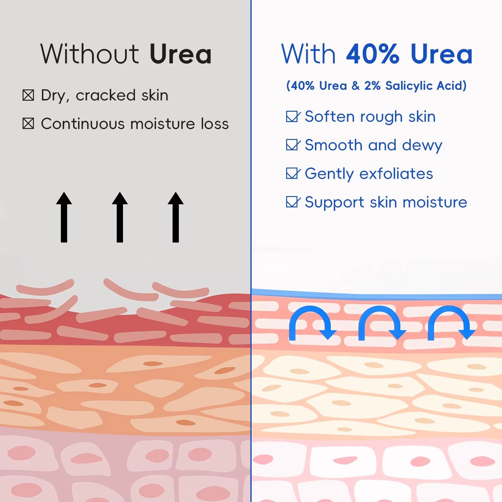 40% Urea & 2% Salicylic Acid Foot Cream – Deep Exfoliating Moisturizing Repair Cream for Cracked Heels, Dry Hands, Rough Elbows & Knees
