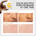 Vitamin C Clay Sleeping Face Mask 12pcs – Deep Cleansing, Pore Minimizing, Brightening & Firming Mud Mask with Hyaluronic Acid & Aloe Extract for All Skin Types