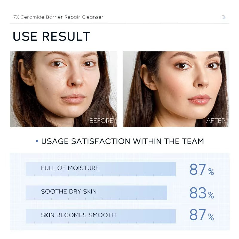 7X Ceramide Barrier Repair Face Cleanser — Deep Pore Cleansing, Acne Soothing & Moisturizing Facial Wash for All Skin Types (100g)