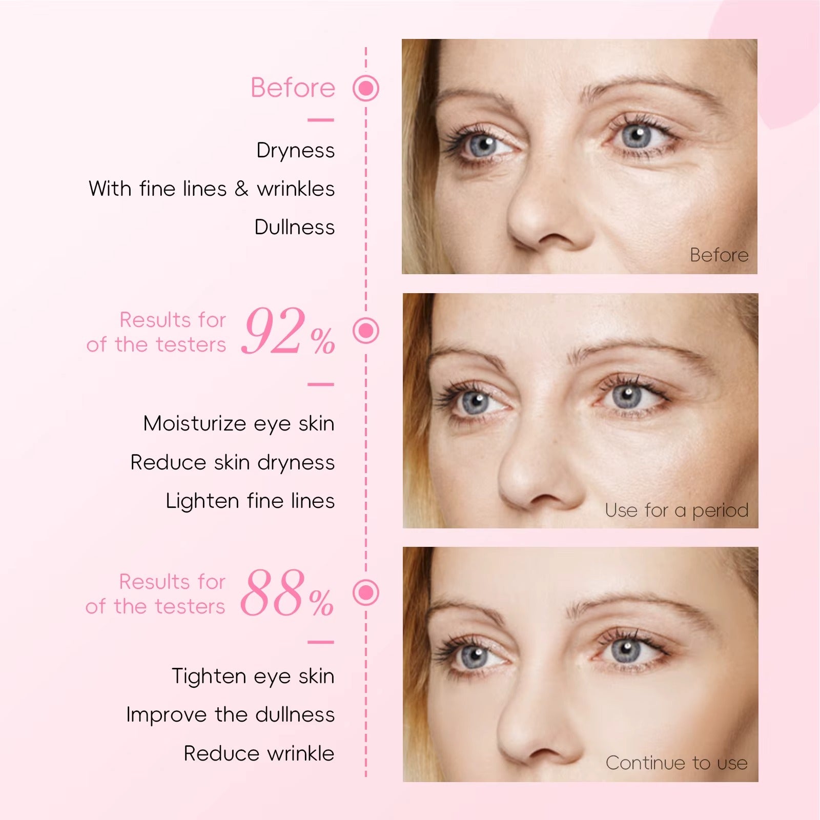 Japan Cherry Blossom Eye Serum Roller 15ml — Targets Dark Circles, Puffiness & Fine Lines — Niacinamide, Vitamin C & Hyaluronic Acid