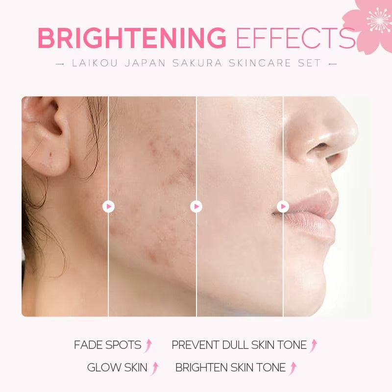 5-Piece Japan Sakura Complete Skincare Bundle — Cleanser, Toner, Eye Cream, Serum & Essence Cream — Even Skin Tone, Fade Dark Spots for Radiant & Firm Skin