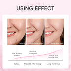 Japan Sakura Moisturizing Face Sheet Mask — Deep Hydration, Pore Cleansing & Firming Korean Skincare (10 Pcs)