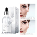 Niacinamide Face Serum with Hyaluronic Acid 100ml — Brightening & Pore-Minimizing Serum for All Skin Types