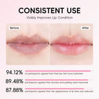 Japan Sakura Overnight Lip Balm Mask — Deep Hydrating & Moisturizing Lip Care Cream That Evens Lip Tone, Softens Lip Lines, Fights Dryness & Flaking with Sakura Extract, Shea Butter, Jojoba Oil & Vitamin E — 3.5g