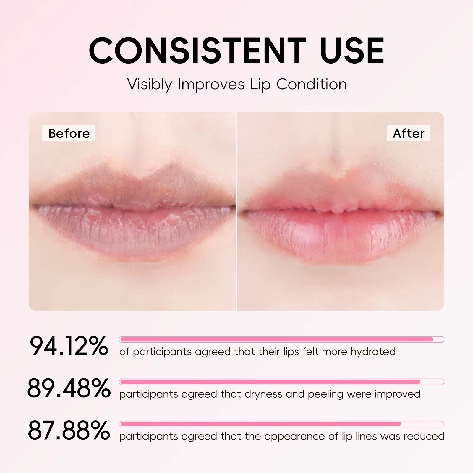 Japan Sakura Overnight Lip Balm Mask — Deep Hydrating & Moisturizing Lip Care Cream That Evens Lip Tone, Softens Lip Lines, Fights Dryness & Flaking with Sakura Extract, Shea Butter, Jojoba Oil & Vitamin E — 3.5g