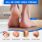 40% Urea & 2% Salicylic Acid Foot Cream – Deep Exfoliating Moisturizing Repair Cream for Cracked Heels, Dry Hands, Rough Elbows & Knees