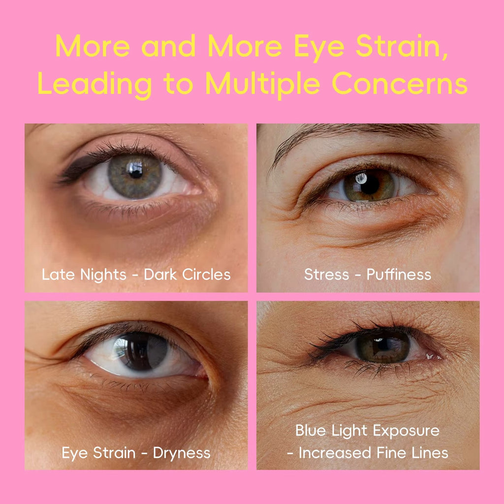 5-in-1 Glow Up Super Eye Cream 20g — Anti-Wrinkle, Dark Circles, Puffiness & Fine Lines — Retinol, Hyaluronic Acid & Glutathione — 360° Roller Massage — All Skin Types