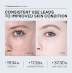 7X Ceramide Barrier Repair Face Cream — Brightening, Fade Dark Spots & Blemishes, Deep Moisturizer & Nourishing Cream for Dry & Sensitive Skin 50g