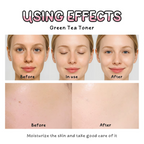 Green Tea Toner 100ml – Deep Hydrating, Pore Minimizing & Oil Control Facial Mist with Witch Hazel & Seaweed for Oily and Sensitive Skin
