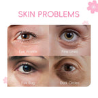 Japan Cherry Blossom Eye Serum Roller 15ml — Targets Dark Circles, Puffiness & Fine Lines — Niacinamide, Vitamin C & Hyaluronic Acid