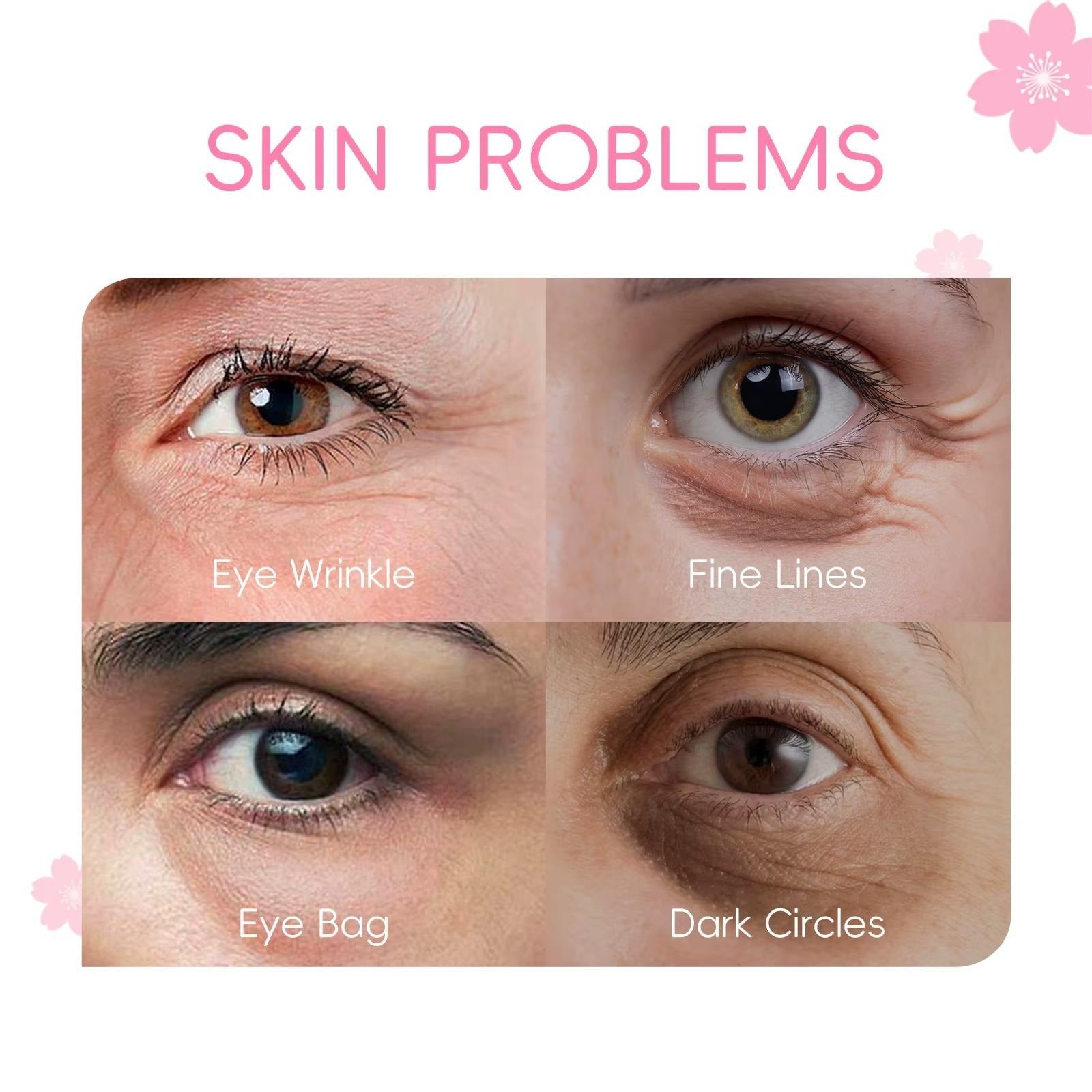 Japan Cherry Blossom Eye Serum Roller 15ml — Targets Dark Circles, Puffiness & Fine Lines — Niacinamide, Vitamin C & Hyaluronic Acid