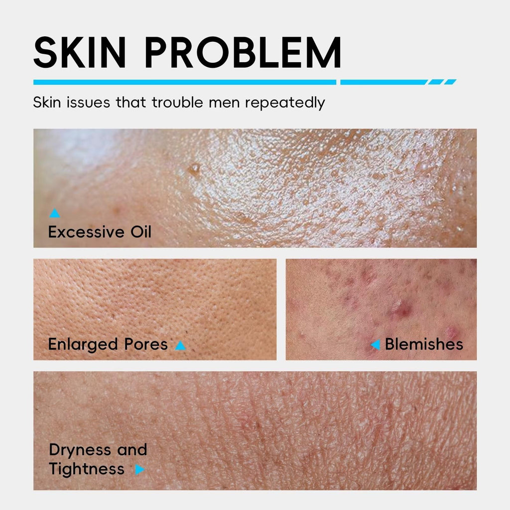 3-in-1 Men's Daily Skincare Set — Oil Control, Hyaluronic Acid Hydration & Skin Barrier Repair for All Skin Types