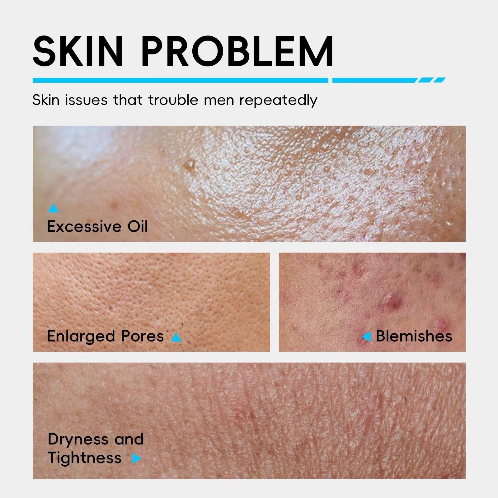 3-in-1 Men's Daily Skincare Set — Oil Control, Hyaluronic Acid Hydration & Skin Barrier Repair for All Skin Types