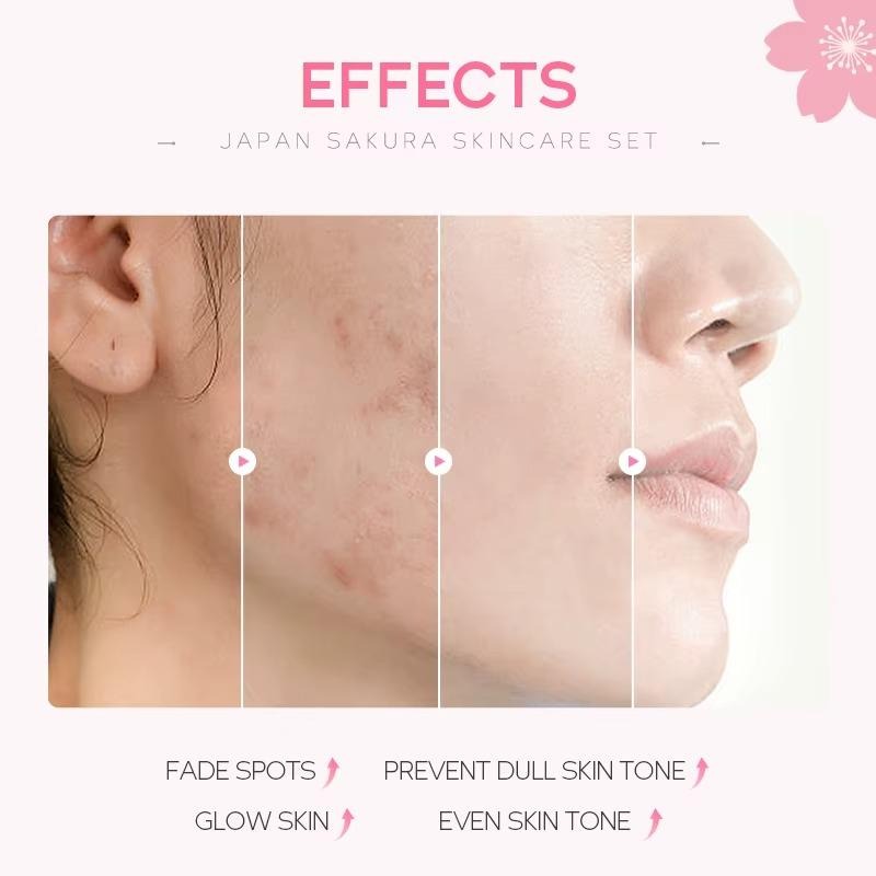 Compact-sized Japan Sakura 4-Piece Skincare Set — Complete Routine for Brightening, Hydration & Anti-Aging