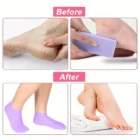 1-Pair Silicone Moisturizing Socks for Women – Cracked Heel & Dry Feet Treatment